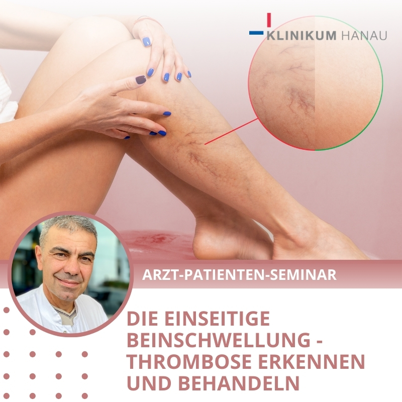 Thrombose Titelbild Klinikum Hanau